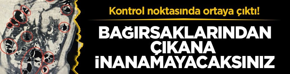 Kontrol noktasında ortaya çıktı! Mide ve bağırsaklarından çıkana inanamayacaksınız