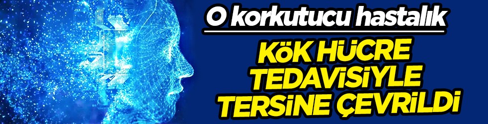Parkinson, kök hücre tedavisi: Onlarca yıldır rahatsız olanları ilgilendiriyor! Tersine çevrildi! Sonuç duş etkisi yaptı