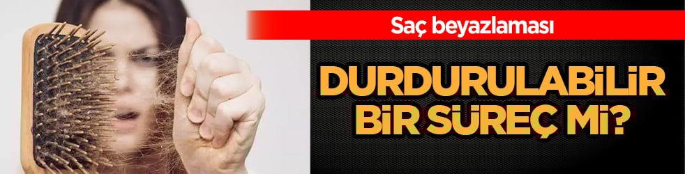 Raporu araştırmacı açıkladı: Beyaz saça karşı umut görünmüyor mu? Yeni bir araştırma: Sözleri yeniden konuşuldu