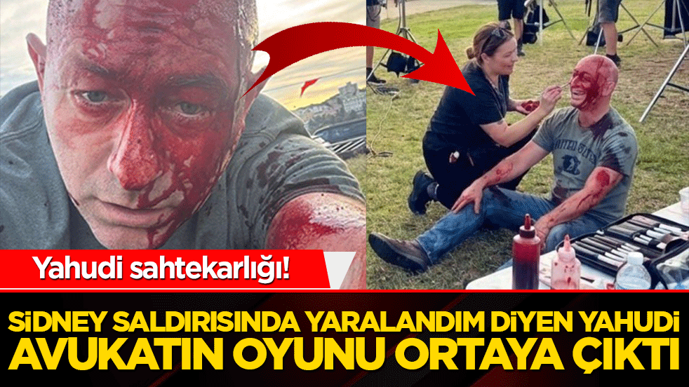 Sahte yarayla mağduriyet oyunu! Gerçek sonradan ortaya çıktı