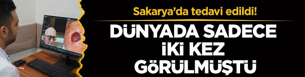 Sakarya’da tedavi edildi! Dünyada sadece iki kez görülmüştü