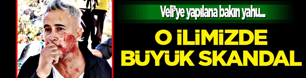 Skandala bakın... Kaş’ta maç sonrası şiddet olayı: Çenesi kırılan velinin tedavisi sürüyor