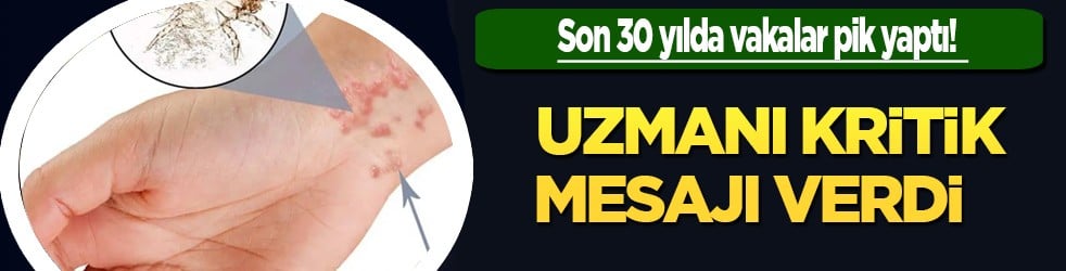 Son 30 yılda vakalar pik yaptı! Prof. Dr. Kritik mesajı verdi: 3 yıl kadar sürüyor, bir anda ortaya çıkan kötü haber 