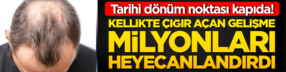 Tarihi dönüm noktası kapıda! Kellikte çığır açan gelişme milyonları heyecanlandırdı