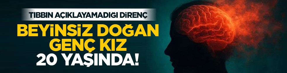 Tıbbın açıklayamadığı direnç: Beyinsiz doğan genç kız 20 yaşında!