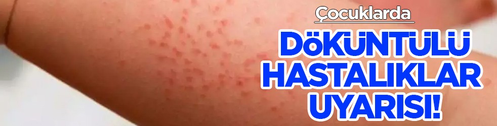 Uzm. Dr. Erdoğan: Çocukluk çağında su çiçeği ve kabakulak sık görülür uyarısı yapıyor! Hangi belirti ne anlama geliyor? 