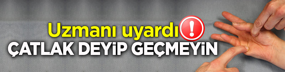 Uzmanı uyardı! Çatlak deyip geçmeyin