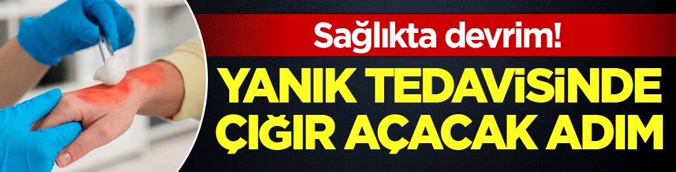 Yanık tedavisinde yeni dönem: Hedef ilk müdahalede hatasız uygulama