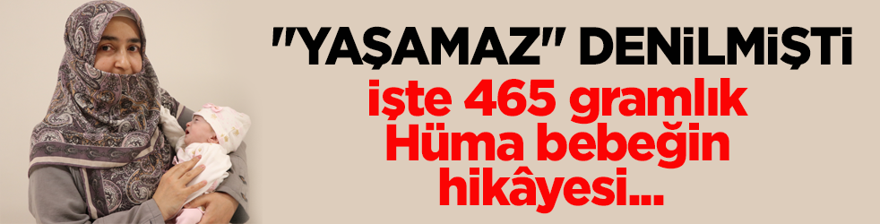 "Yaşamaz" denilmişti! 465 gramlık Hüma bebek anne kucağına kavuştu
