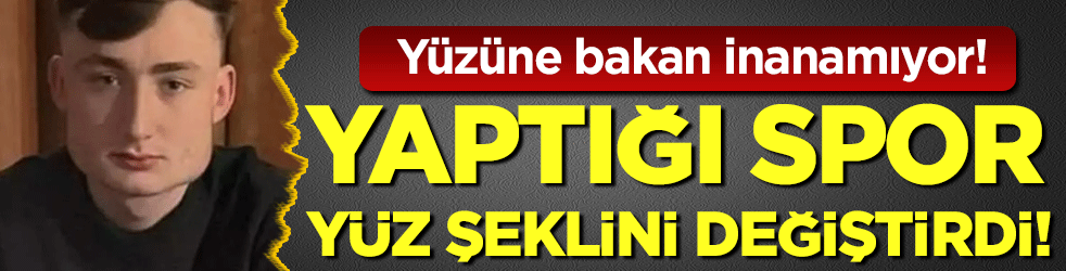 Yüzüne bakan inanamıyor: Yaptığı spor yüz şeklini değiştirdi!