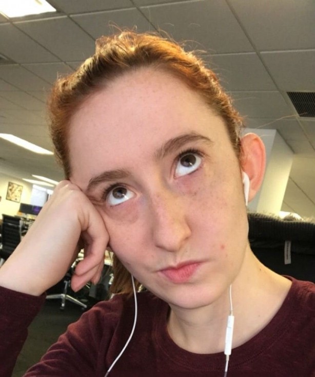 Foto - 1 ay boyunca her gün elma yerseniz bakın ne oluyor! Resmen denendi