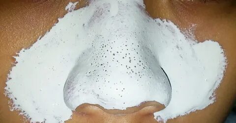 Foto - 1 kez uygulamak yetiyor! Bu metod siyah noktaları vakum gibi çekiyor