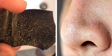 Foto - 1 kez uygulamak yetiyor! Bu metod siyah noktaları vakum gibi çekiyor