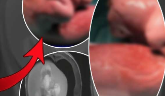 Foto - 1 yaşındaki bebek, kafası geniş olduğu için hastaneye götürüldü! Gerçek bir sene sonra ortaya çıktı! Meğerse beyninin içinde... Bilim dünyası şokta