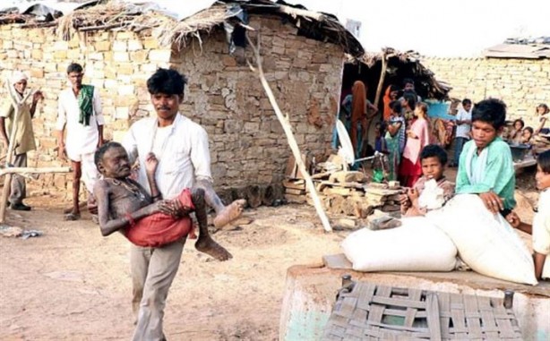 Foto - 10 günde bir yılan gibi deri değiştiriyor