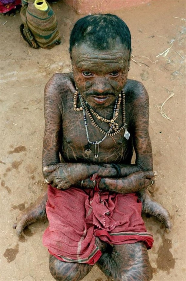 Foto - 10 günde bir yılan gibi deri değiştiriyor