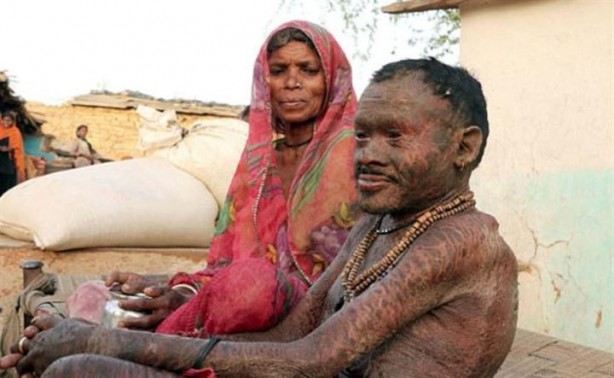 Foto - 10 günde bir yılan gibi deri değiştiriyor