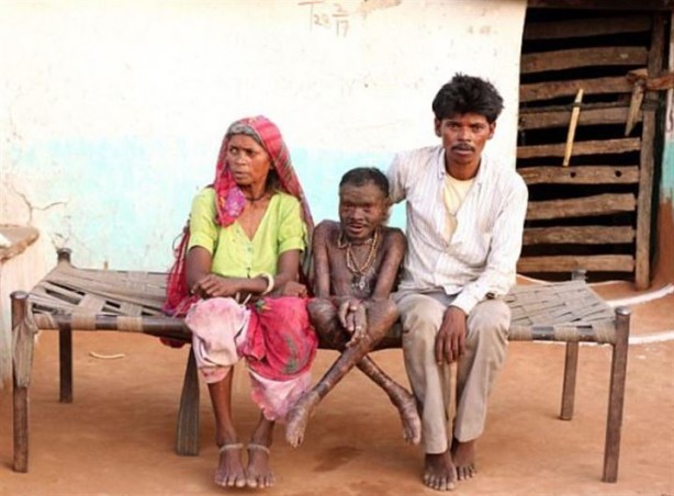 Foto - 10 günde bir yılan gibi deri değiştiriyor