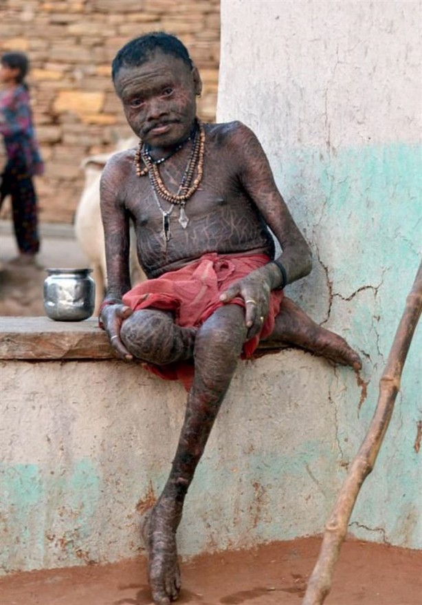 Foto - 10 günde bir yılan gibi deri değiştiriyor