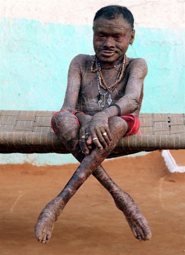 Foto - 10 günde bir yılan gibi deri değiştiriyor