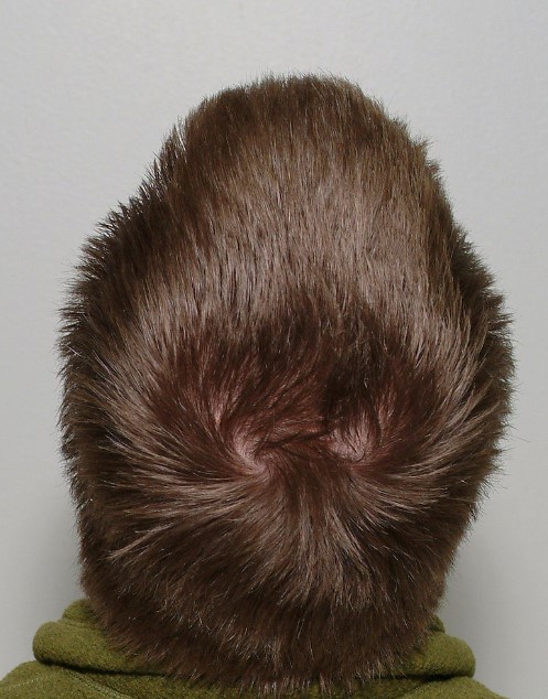 Foto - 10 yaş gençleştiriyor! Canan Karatay, yere göğe sığdıramadığı besini açıkladı