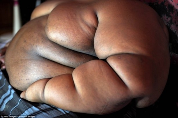 Foto - 10 yaşında ama 192 kg ağırlığında!