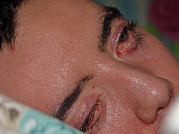 Foto - 10 yıldır gözlerini bir kez bile kırpamadı! Görenlerin içi acıyor