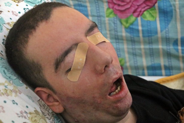 Foto - 10 yıldır gözlerini bir kez bile kırpamadı! Görenlerin içi acıyor