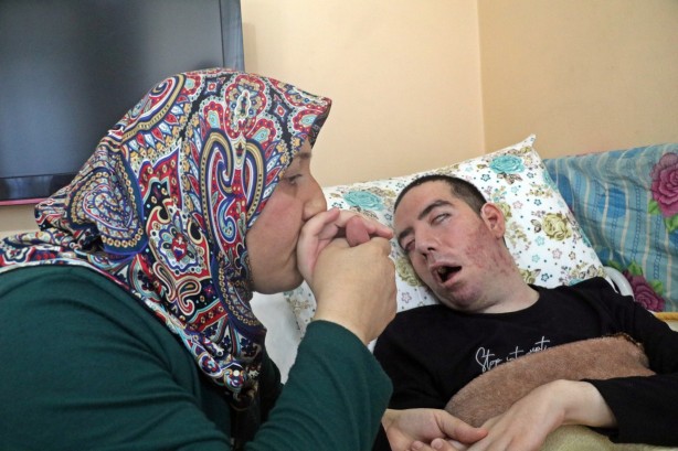 Foto - 10 yıldır gözlerini bir kez bile kırpamadı! Görenlerin içi acıyor