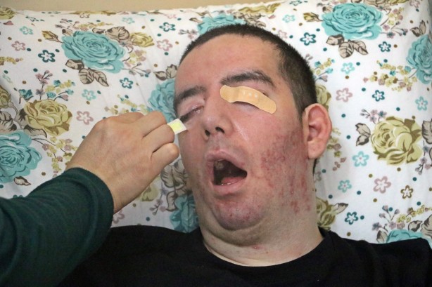 Foto - 10 yıldır gözlerini bir kez bile kırpamadı! Görenlerin içi acıyor