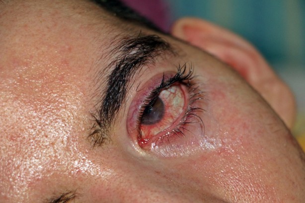 Foto - 10 yıldır gözlerini bir kez bile kırpamadı! Görenlerin içi acıyor
