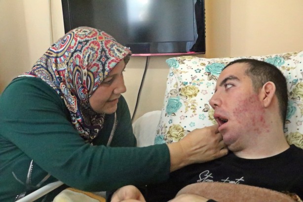 Foto - 10 yıldır gözlerini bir kez bile kırpamadı! Görenlerin içi acıyor