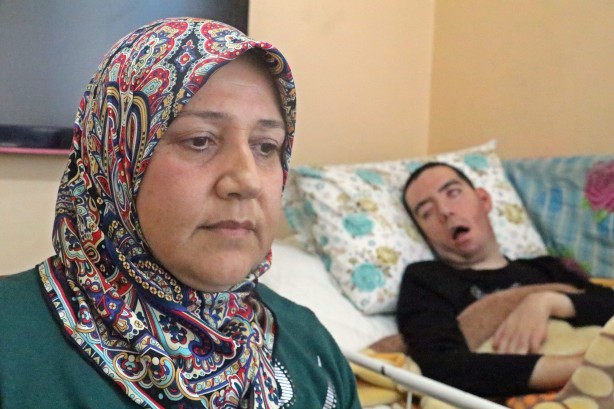 Foto - 10 yıldır gözlerini bir kez bile kırpamadı! Görenlerin içi acıyor