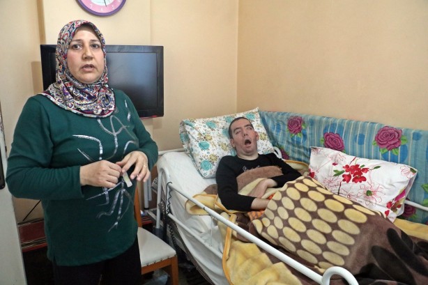 Foto - 10 yıldır gözlerini bir kez bile kırpamadı! Görenlerin içi acıyor