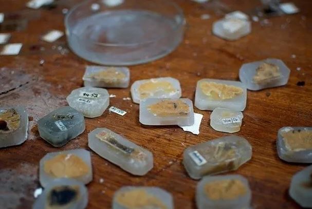 Foto - 100 yıl sonra ortaya çıktı! Akıl hastanelerinin tüyler ürperten kareleri