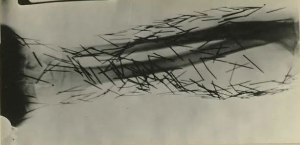 Foto - 100 yıl sonra ortaya çıktı! Akıl hastanelerinin tüyler ürperten kareleri