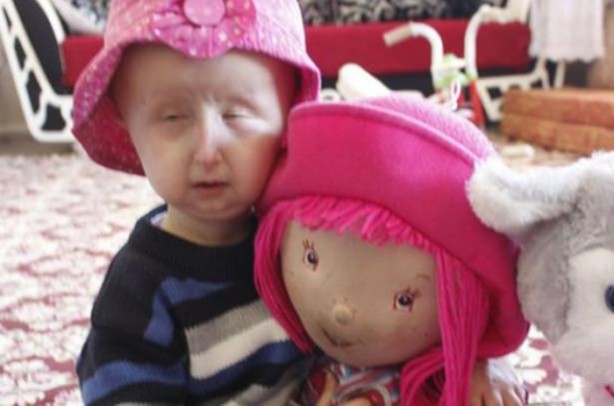 Foto - 11 yaşını göremez dediler ama...