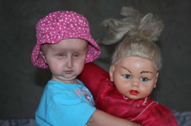 Foto - 11 yaşını göremez dediler ama...