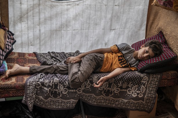 Foto - 12 yaşındaki çocuk yatağında ölümü bekliyor