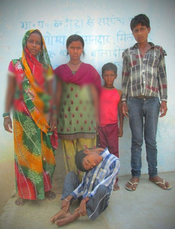 Foto - 12 yıl bu halde yaşadı!