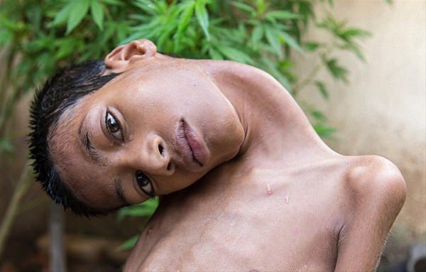 12 yıl bu halde yaşadı!