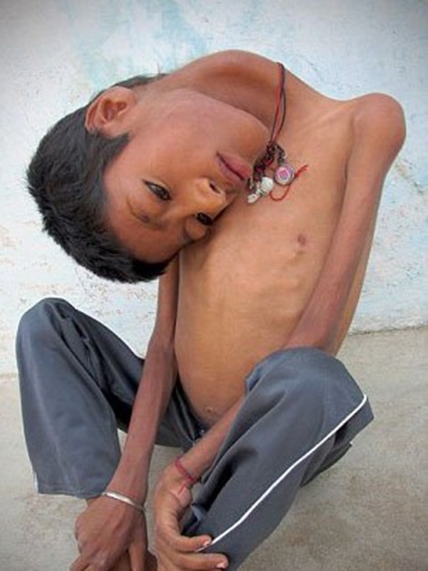 Foto - 12 yıl bu halde yaşadı!