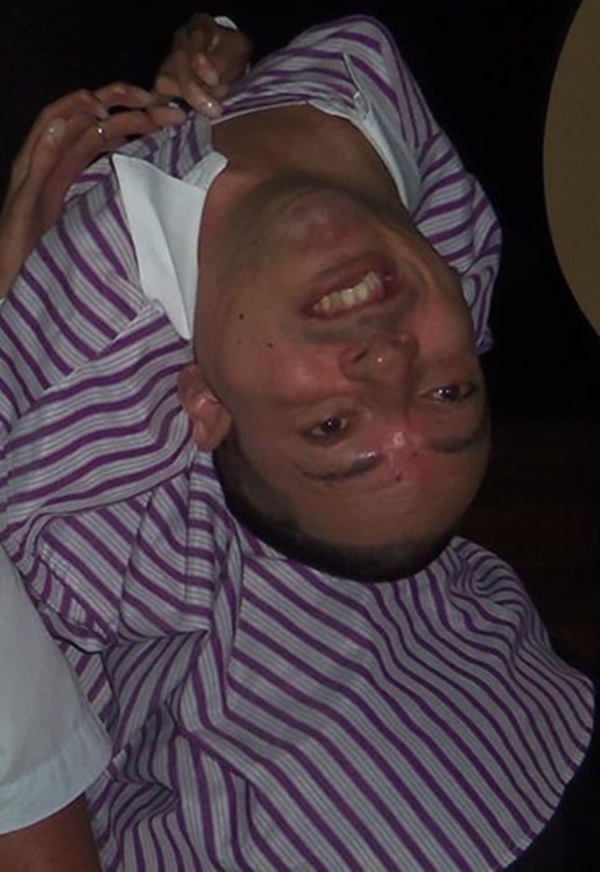 Foto - 12 yıl bu halde yaşadı!