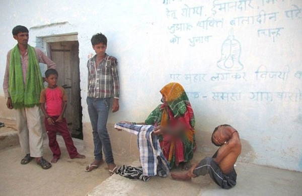 Foto - 12 yıl bu halde yaşadı!