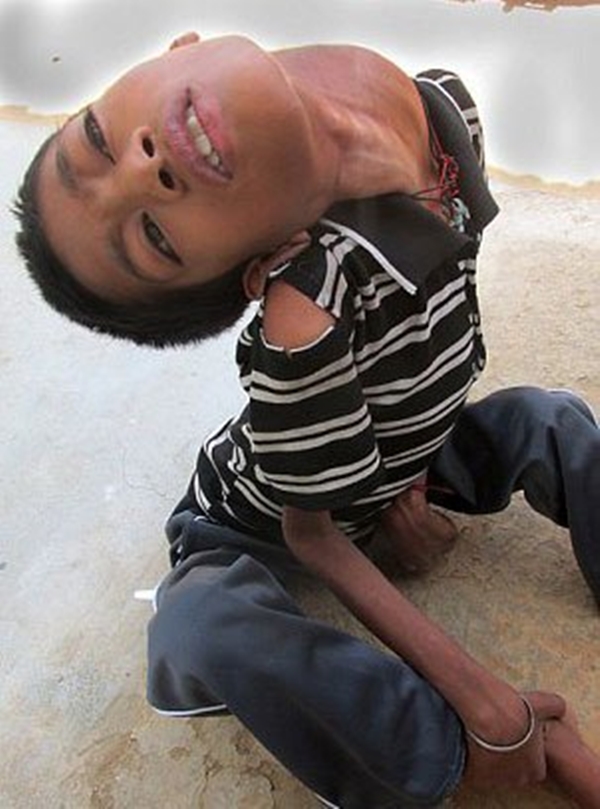 Foto - 12 yıl bu halde yaşadı!