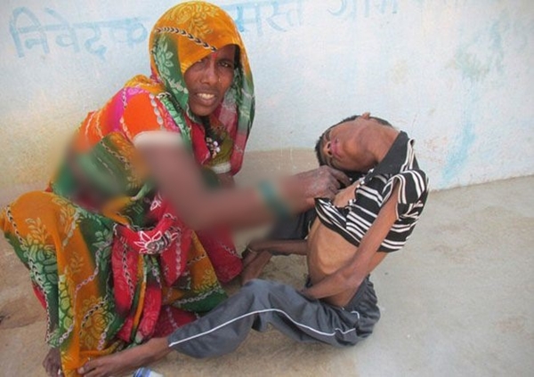 Foto - 12 yıl bu halde yaşadı!