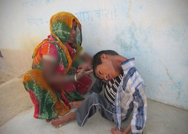 Foto - 12 yıl bu halde yaşadı!