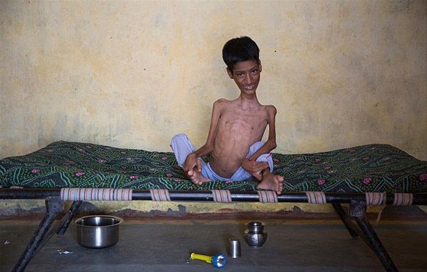 Foto - 12 yıl bu halde yaşadı!