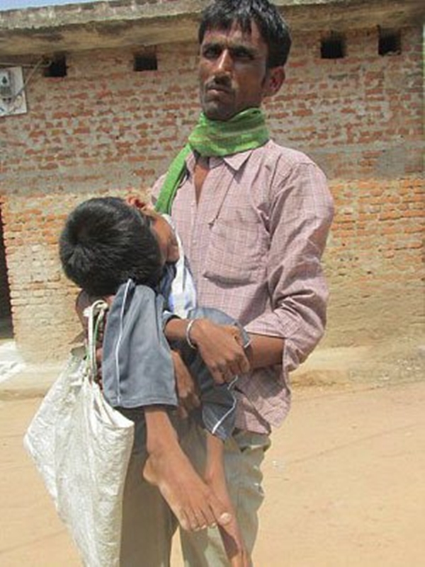 Foto - 12 yıl bu halde yaşadı!