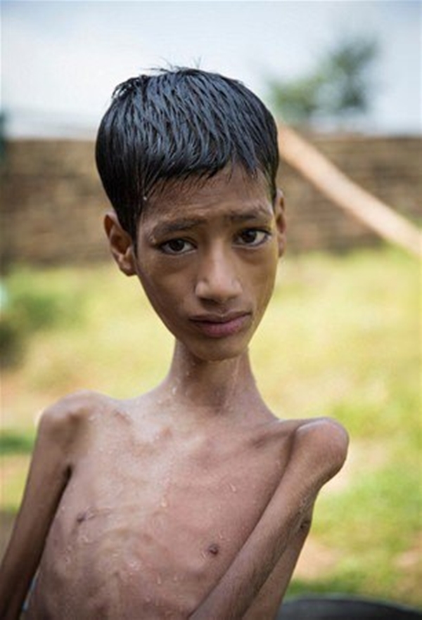 Foto - 12 yıl bu halde yaşadı!